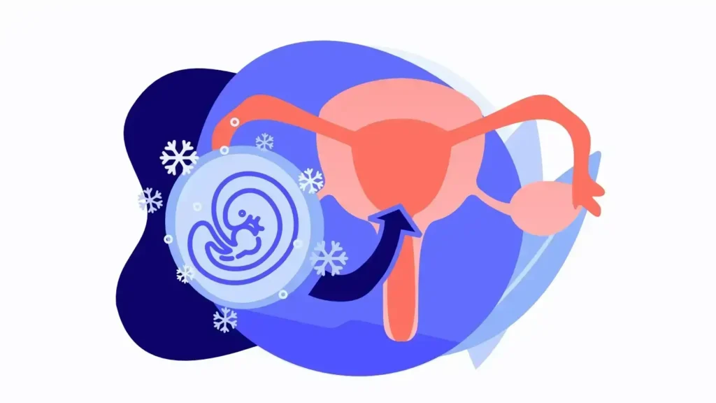 Frozen Embryo Transsfer