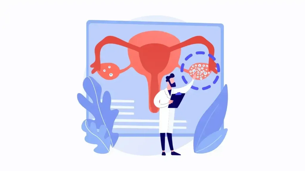PCOS